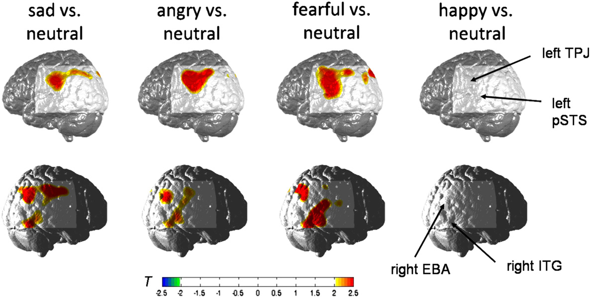 NIRS activity for emotional body expressions