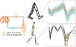 Gait in hereditary spastic paraplegia – from axonal degeneration to movement disorder