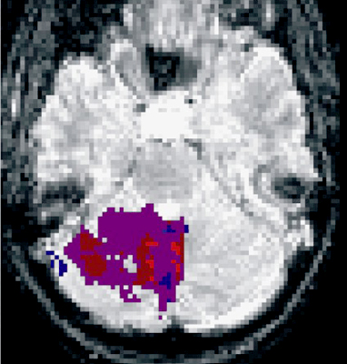 Motor learning and the functional role of the cerebellum